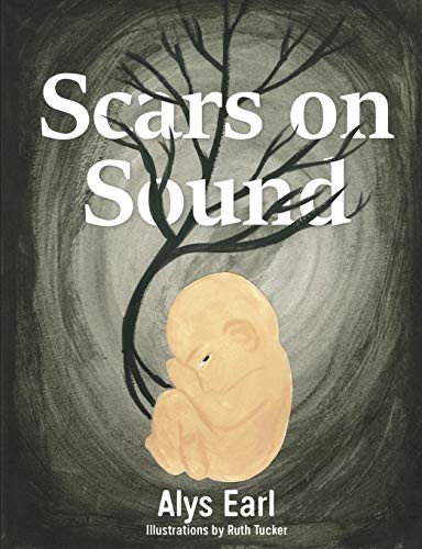 Alys Earl: Scars on Sound (Paperback, 2017, lulu.com, Lulu.com)